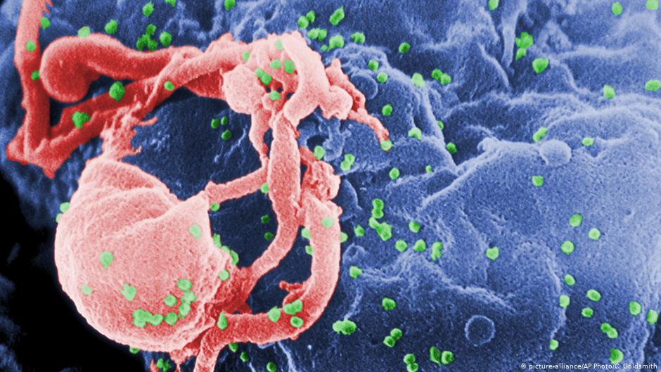 صورة أعراض الإيدز على الجهاز التناسلي