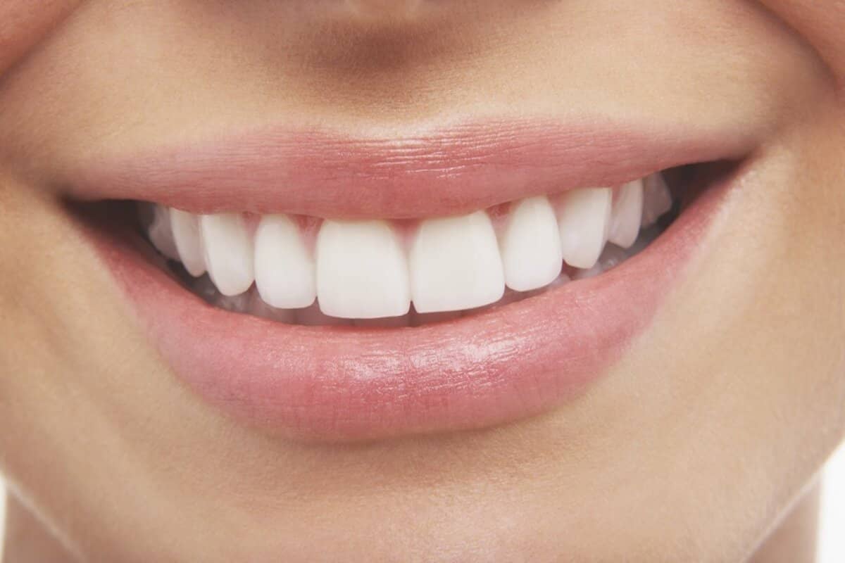 كيفية ازالة التسوس من الأسنان