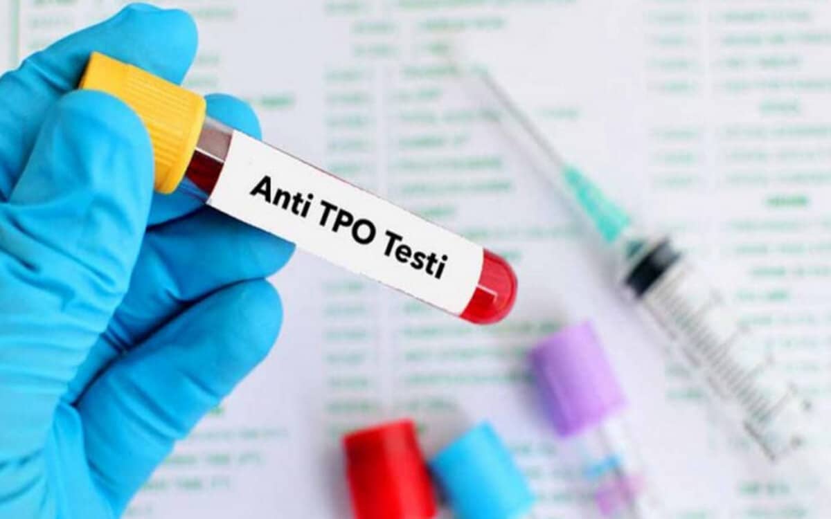 سعر تحليل الأجسام المضادة للغدة الدرقية anti tpo