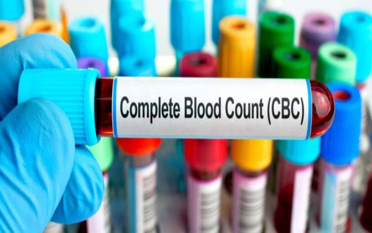 سعر تحليل cbc صورة الدم الكاملة في معامل التحاليل الطبية