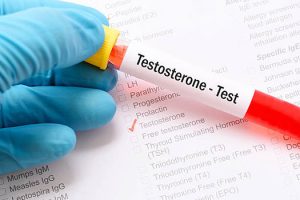 سعر تحليل التستوستيرون الحر free testosterone