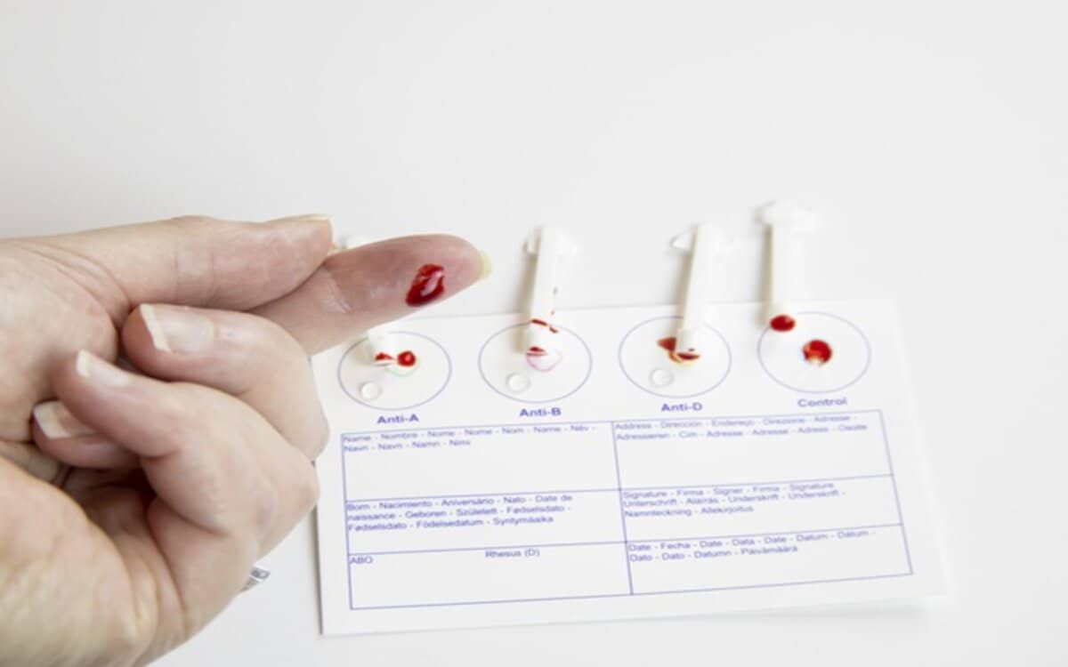 سعر تحليل فصيلة الدم