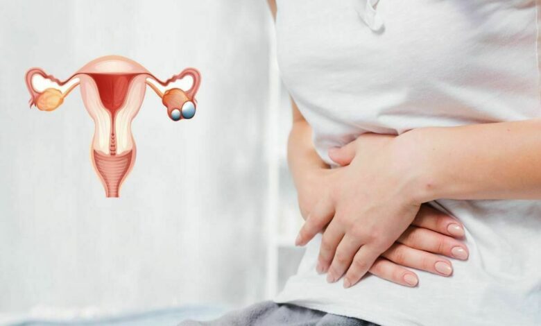 روشتة لعلاج تكيس المبايض